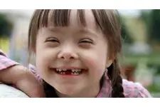 Down Sendromu Fiziksel Belirtileri Nelerdir? Down Sendromu Fiziksel Belirtileri Nelerdir?