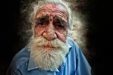 Stendhal Sendromu Belirtileri ve Tedavisi Stendhal Sendromu Belirtileri ve Tedavisi