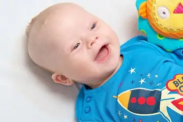 Down Sendromu Çeşitleri Nelerdir?