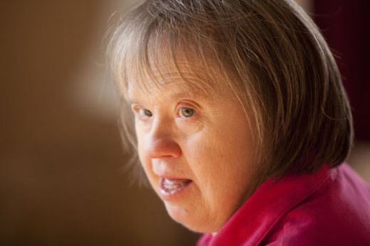 Down Sendromu Özellikleri Nelerdir?