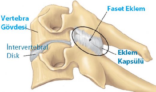 Faset Sendromu Belirtileri ve Tedavisi