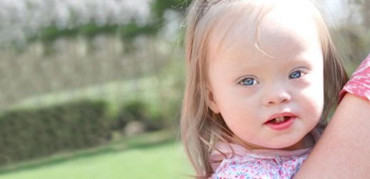 Hafif Down Sendromu Belirtileri