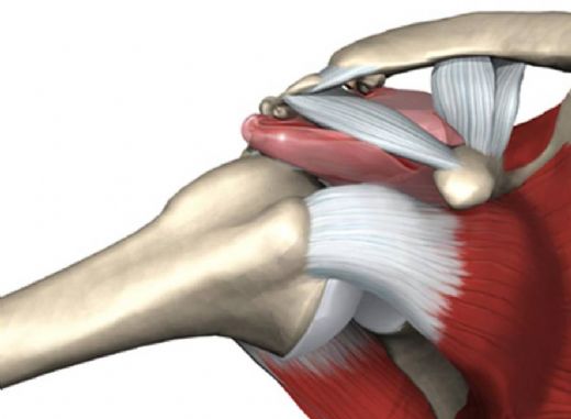 İmpingement Sendromu Belirtileri ve Tedavisi