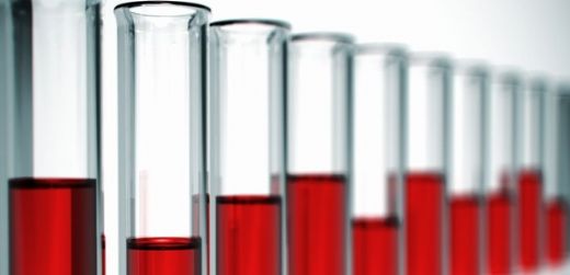 Miyelodisplastik Sendrom Belirtileri ve Tedavisi