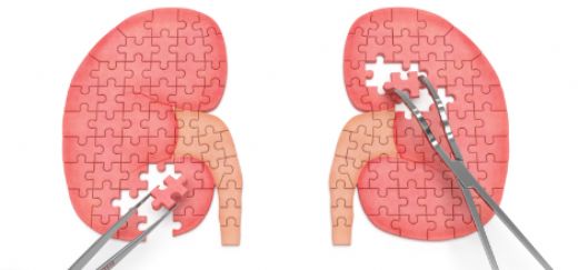 Nefrotik Sendrom Belirtileri ve Tedavisi