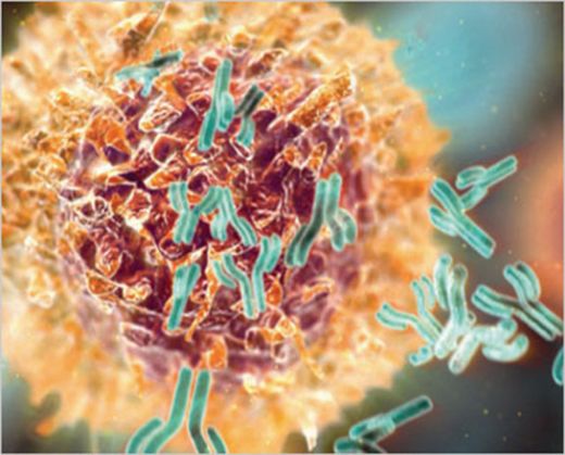 Tümör Lizis Sendromu Belirtileri ve Tedavisi